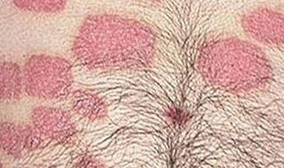 More than one pink compounds in the abdomen