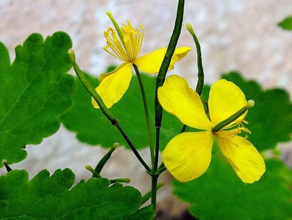 Celandine for Psoriasis Treatment