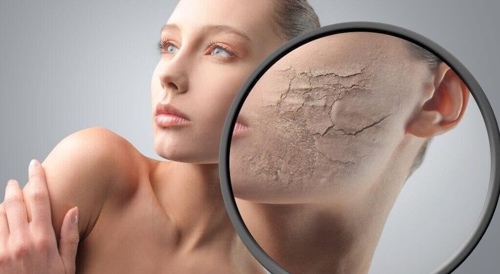 Destruction of skin