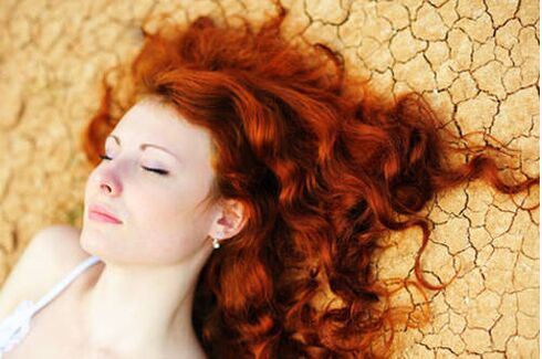 A girl with psoriasis